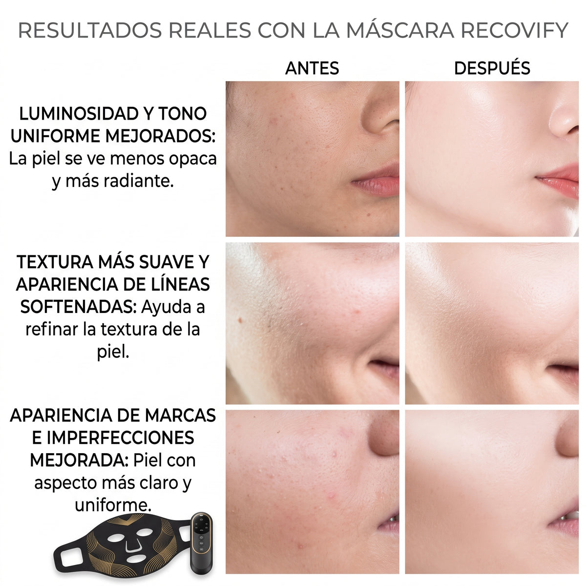 Resultados visuales del uso de la mascara luz led facial para mejorar la apariencia del rostro